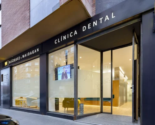 Fachadas para locales comerciales en Valencia